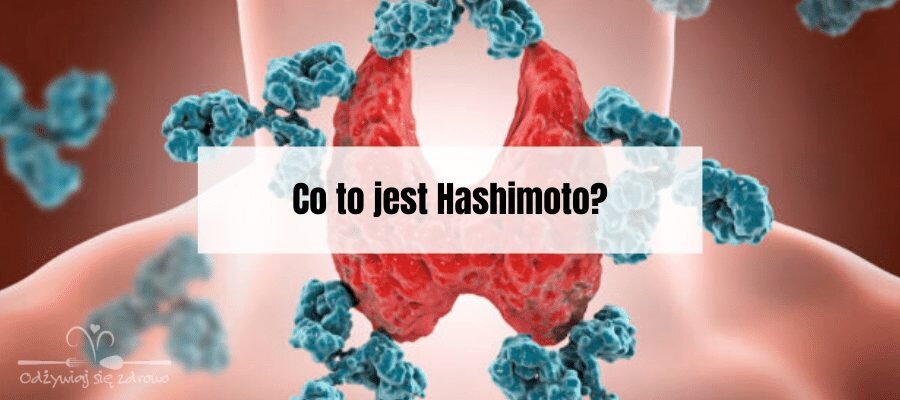 Co to jest Hashimoto?